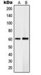 Serine/threonine-protein kinase PLK5 antibody, orb215361, Biorbyt, Western Blot image 