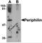Periphilin 1 antibody, 6687, ProSci Inc, Western Blot image 