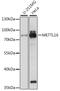 Methyltransferase Like 16 antibody, A15345, Boster Biological Technology, Western Blot image 