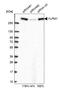 YLP Motif Containing 1 antibody, HPA061123, Atlas Antibodies, Western Blot image 