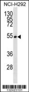 Serine And Arginine Rich Splicing Factor 11 antibody, 56-765, ProSci, Western Blot image 