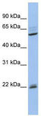 DAX1 antibody, TA329362, Origene, Western Blot image 
