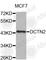 Dynactin Subunit 2 antibody, A2200, ABclonal Technology, Western Blot image 