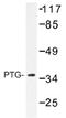 Protein Phosphatase 1 Regulatory Subunit 3C antibody, AP01499PU-N, Origene, Western Blot image 