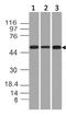Keratin 76 antibody, M12092, Boster Biological Technology, Western Blot image 