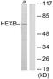 Hexosaminidase Subunit Beta antibody, PA5-38571, Invitrogen Antibodies, Western Blot image 