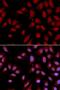 DLG Associated Protein 5 antibody, LS-C331976, Lifespan Biosciences, Immunofluorescence image 