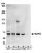 Nucleoporin 85 antibody, A303-978A, Bethyl Labs, Western Blot image 