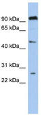 Chromosome 1 Open Reading Frame 174 antibody, TA335107, Origene, Western Blot image 