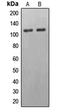 Erythrocyte Membrane Protein Band 4.1 Like 2 antibody, LS-C352159, Lifespan Biosciences, Western Blot image 