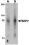 Folliculin-interacting protein 2 antibody, TA306734, Origene, Western Blot image 