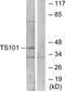 Tumor Susceptibility 101 antibody, TA312310, Origene, Western Blot image 