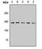 Polybromo 1 antibody, LS-C668796, Lifespan Biosciences, Western Blot image 