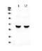 Glutamate Decarboxylase 2 antibody, A03142-1, Boster Biological Technology, Western Blot image 