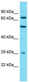 Myotubularin Related Protein 7 antibody, TA332091, Origene, Western Blot image 