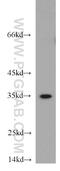 Proteasome Subunit Beta 11 antibody, 55143-1-AP, Proteintech Group, Western Blot image 