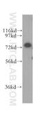 Cleavage And Polyadenylation Specific Factor 3 antibody, 11609-1-AP, Proteintech Group, Western Blot image 