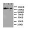 ATP Binding Cassette Subfamily C Member 1 antibody, orb76148, Biorbyt, Western Blot image 