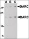 Atypical Chemokine Receptor 1 (Duffy Blood Group) antibody, orb88116, Biorbyt, Western Blot image 