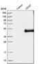 CD207 Molecule antibody, HPA011216, Atlas Antibodies, Western Blot image 