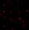 ANTXR Cell Adhesion Molecule 1 antibody, A01563-1, Boster Biological Technology, Immunofluorescence image 