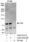 G Protein Signaling Modulator 2 antibody, A303-031A, Bethyl Labs, Immunoprecipitation image 