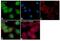 Protein Phosphatase 3 Catalytic Subunit Beta antibody, PA5-15581, Invitrogen Antibodies, Immunofluorescence image 