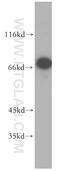 Putative endoplasmin-like protein antibody, 10325-1-AP, Proteintech Group, Western Blot image 