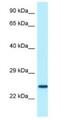 Sclerostin Domain Containing 1 antibody, NBP1-98525, Novus Biologicals, Western Blot image 
