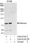 Histone-lysine N-methyltransferase SETMAR antibody, A303-615A, Bethyl Labs, Immunoprecipitation image 