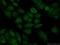 Lysine-specific demethylase 5C antibody, 14426-1-AP, Proteintech Group, Immunofluorescence image 