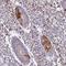 Zinc Finger Protein 835 antibody, HPA051136, Atlas Antibodies, Immunohistochemistry paraffin image 