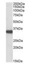 Aspartoacylase antibody, orb22557, Biorbyt, Western Blot image 