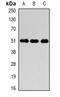 Fibrinogen Gamma Chain antibody, orb378058, Biorbyt, Western Blot image 