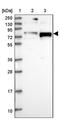 Nucleolar Protein 8 antibody, PA5-60713, Invitrogen Antibodies, Western Blot image 