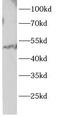 Parkin RBR E3 Ubiquitin Protein Ligase antibody, FNab10088, FineTest, Western Blot image 