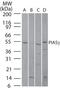 Protein Inhibitor Of Activated STAT 4 antibody, PA1-41047, Invitrogen Antibodies, Western Blot image 