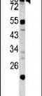 Caldesmon 1 antibody, PA5-13559, Invitrogen Antibodies, Western Blot image 