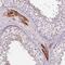Patched Domain Containing 3 antibody, NBP2-14538, Novus Biologicals, Immunohistochemistry paraffin image 