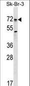 Bone Morphogenetic Protein Receptor Type 1A antibody, LS-B9804, Lifespan Biosciences, Western Blot image 