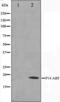 CDKN2A antibody, orb224526, Biorbyt, Western Blot image 