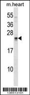 Sclerostin domain-containing protein 1 antibody, 59-173, ProSci, Western Blot image 