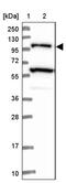 USP6 N-Terminal Like antibody, PA5-58691, Invitrogen Antibodies, Western Blot image 