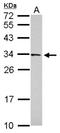 Family With Sequence Similarity 78 Member B antibody, NBP2-16422, Novus Biologicals, Western Blot image 