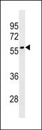 Leucine Rich Repeat Containing 69 antibody, PA5-49157, Invitrogen Antibodies, Western Blot image 