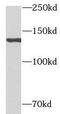 Nuclear Factor Of Activated T Cells 3 antibody, FNab05691, FineTest, Western Blot image 