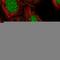 Probable ATP-dependent RNA helicase DDX11 antibody, HPA065197, Atlas Antibodies, Immunofluorescence image 