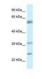 V-Set And Immunoglobulin Domain Containing 10 antibody, orb325477, Biorbyt, Western Blot image 
