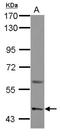 Amiloride-sensitive cation channel 2, neuronal antibody, NBP2-15240, Novus Biologicals, Western Blot image 