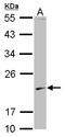 S-Phase Kinase Associated Protein 1 antibody, LS-C155330, Lifespan Biosciences, Western Blot image 
